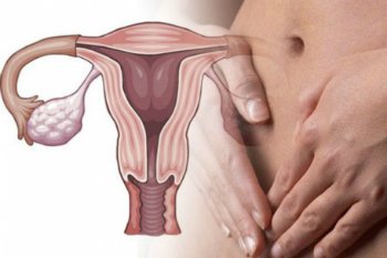 Фото:Дисфункция одного яичника:Симптомы.